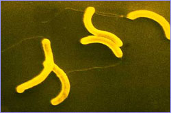 Vibrio cholerae